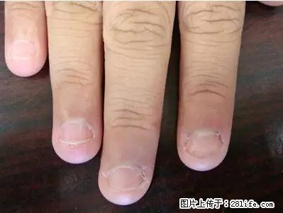剪指甲、挖耳屎，这些日常小动作竟隐藏大危害！ - 丹东生活资讯 - 丹东28生活网 dandong.28life.net
